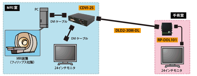 MRI映像をMRI室と手術室の24インチモニタに高解像度表示